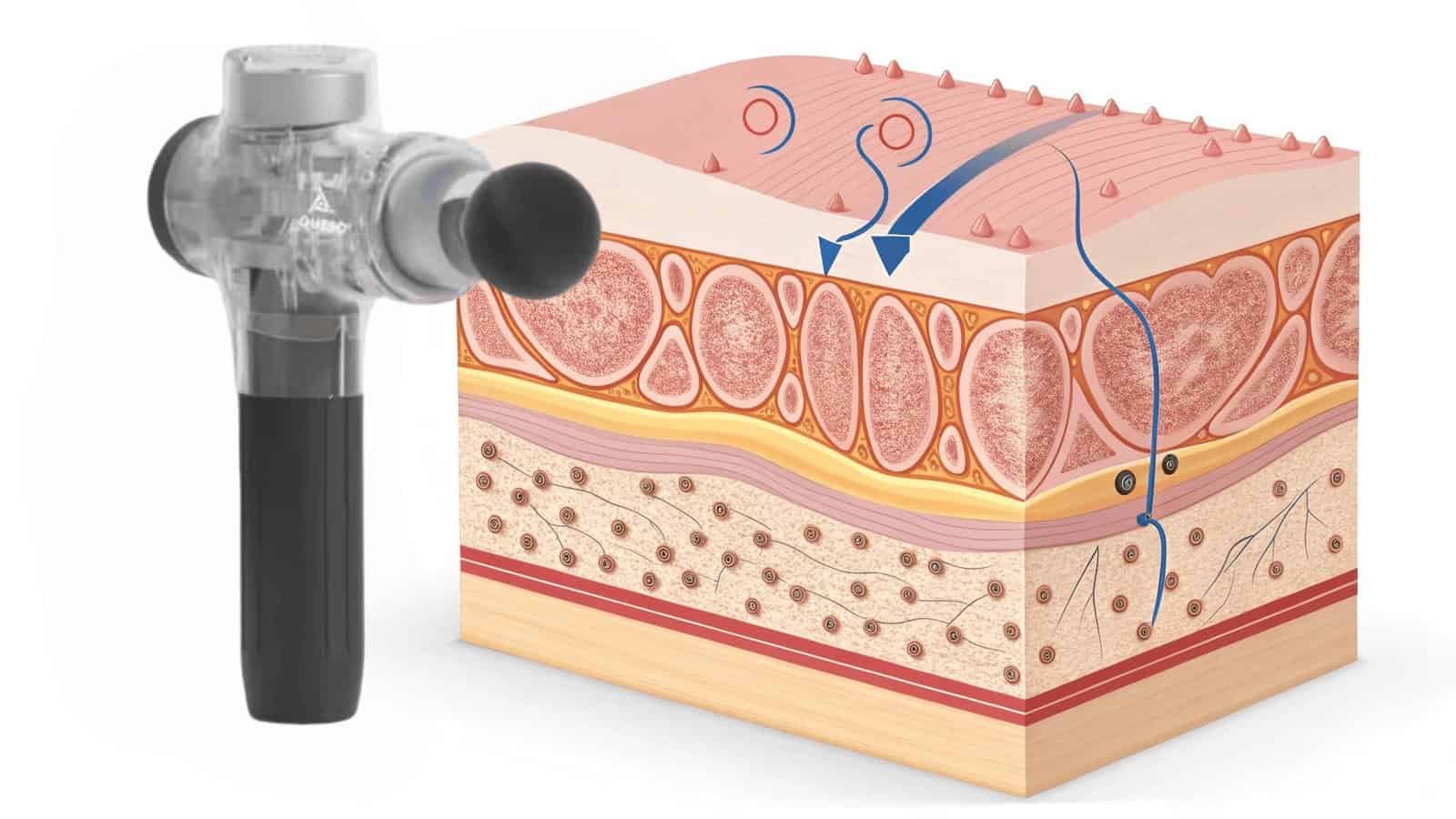 Does a massage gun break up fascia