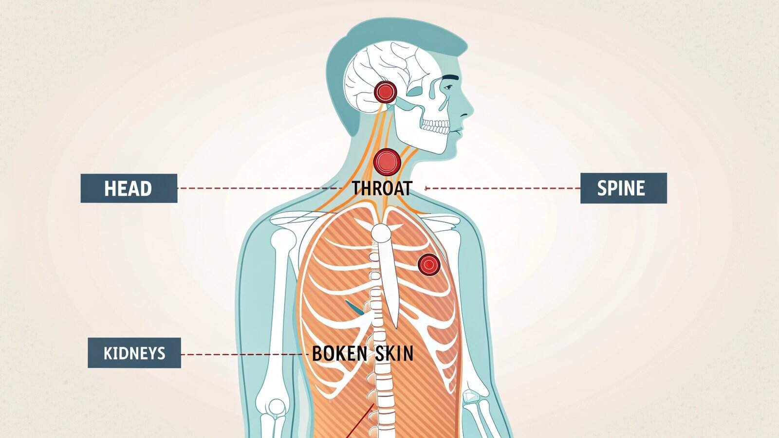 Head and neck anatomy diagram showing muscles and nerves, with focus on throat area for medical or rehabilitation purposes.