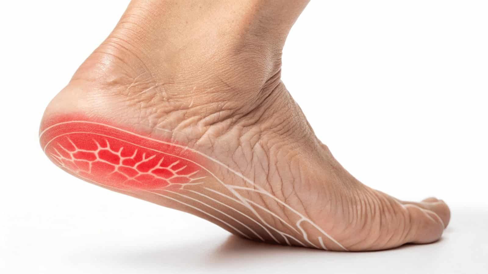 What are the causes of heel pain?
